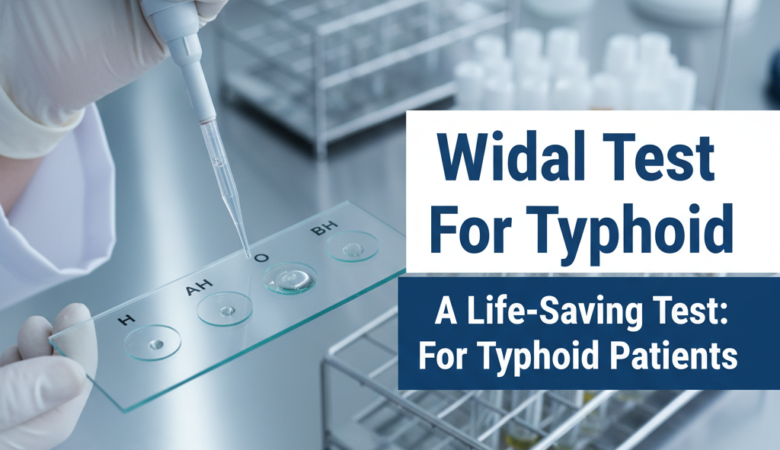 Widal Test For Typhoid: A Life-Saving Test For Typhoid Patients