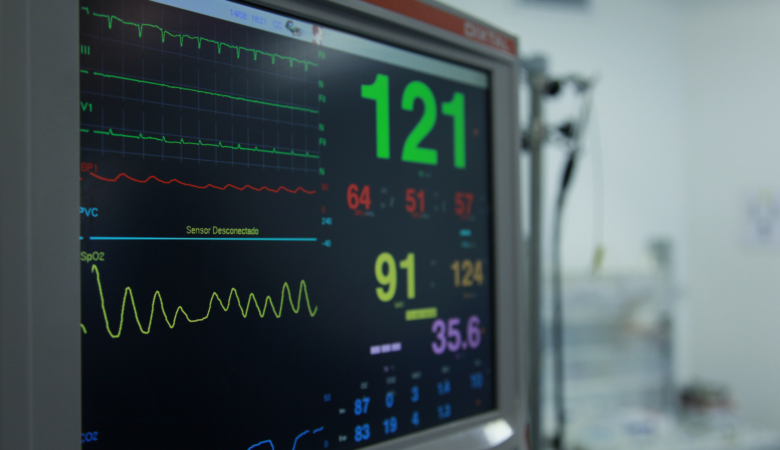 Female ECG: Understanding Heart Health in Women