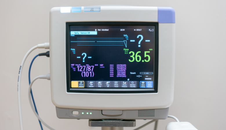 How an ECG is Done for a Female: A Comprehensive Guide