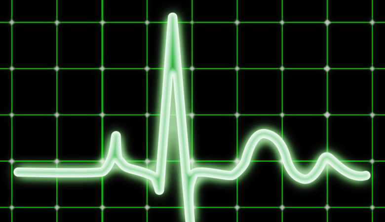 How is an ECG Done?