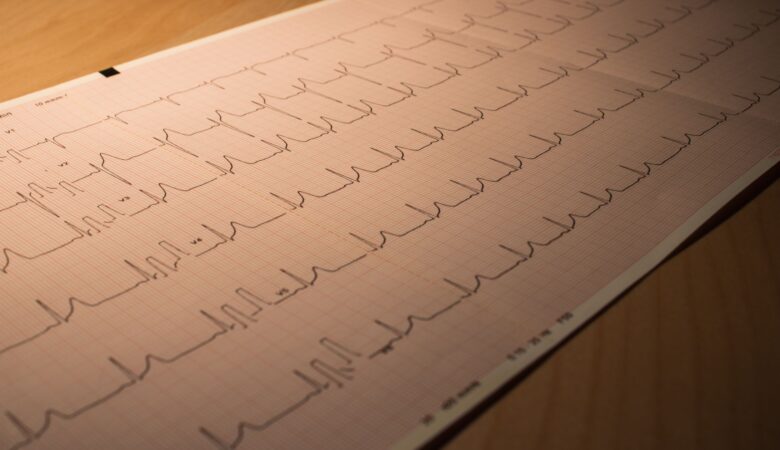 ECG Test Meaning: What You Need to Know About This Vital Diagnostic Tool