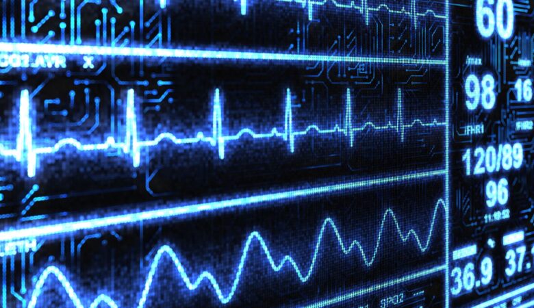 ECG Test Means: How It Works, and Why It Matters for Your Heart Health