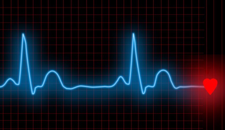 Women’s ECG: A Complete Overview