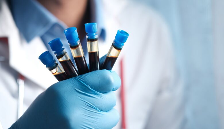 Understanding TLC in Blood Tests: A Quick Guide