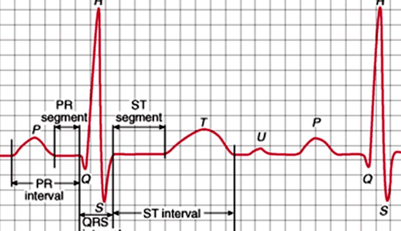 How ECG Is Done for Women: A Quick Guide