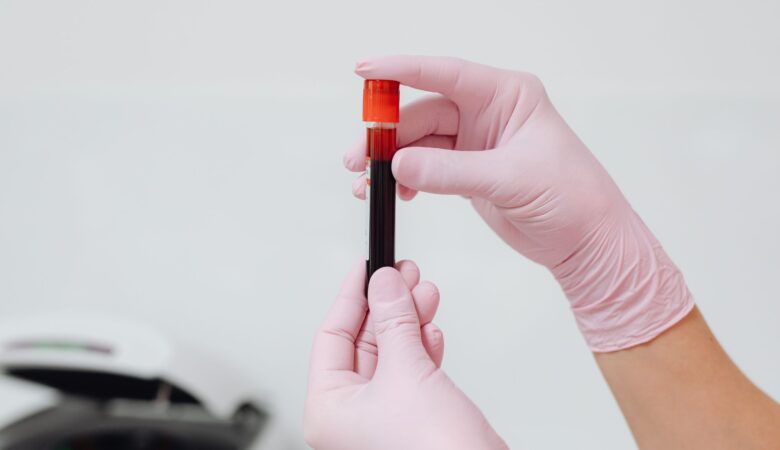 Essential GI Tests and Procedures Explained