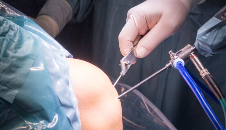 Top Orthopaedic Specialist in Bangalore for Reliable Treatment