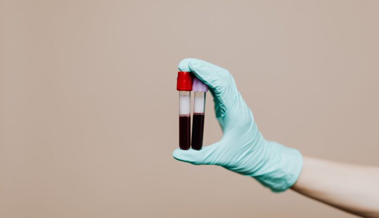 Complete Blood Test for Overall Health Insights