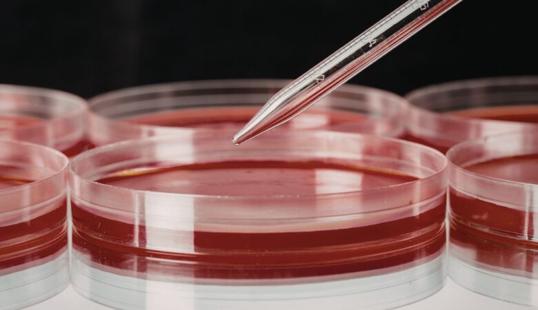 Laboratory Blood Analysis: Unlocking Insights for Better Health